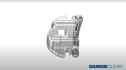 image of Damon Clear Invisible Braces